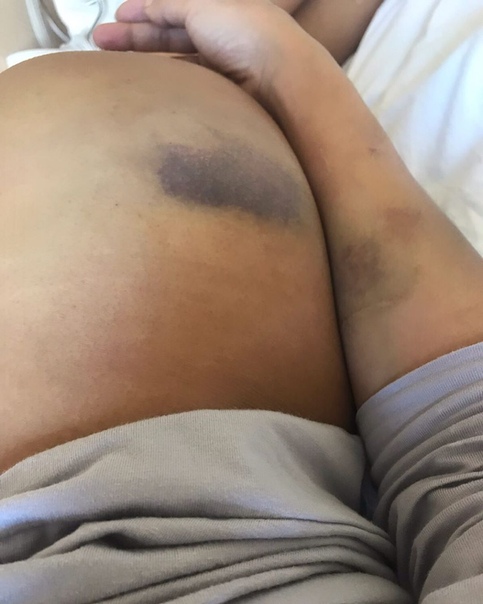 Либерж Кпадону избили!